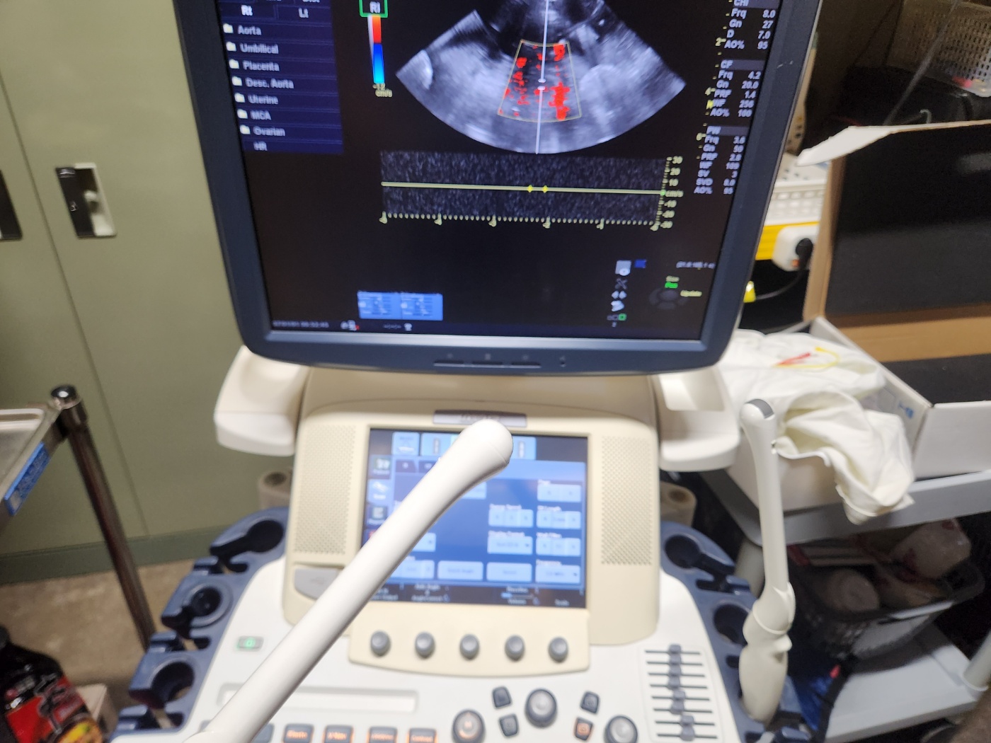 GE IC5-9-D probe