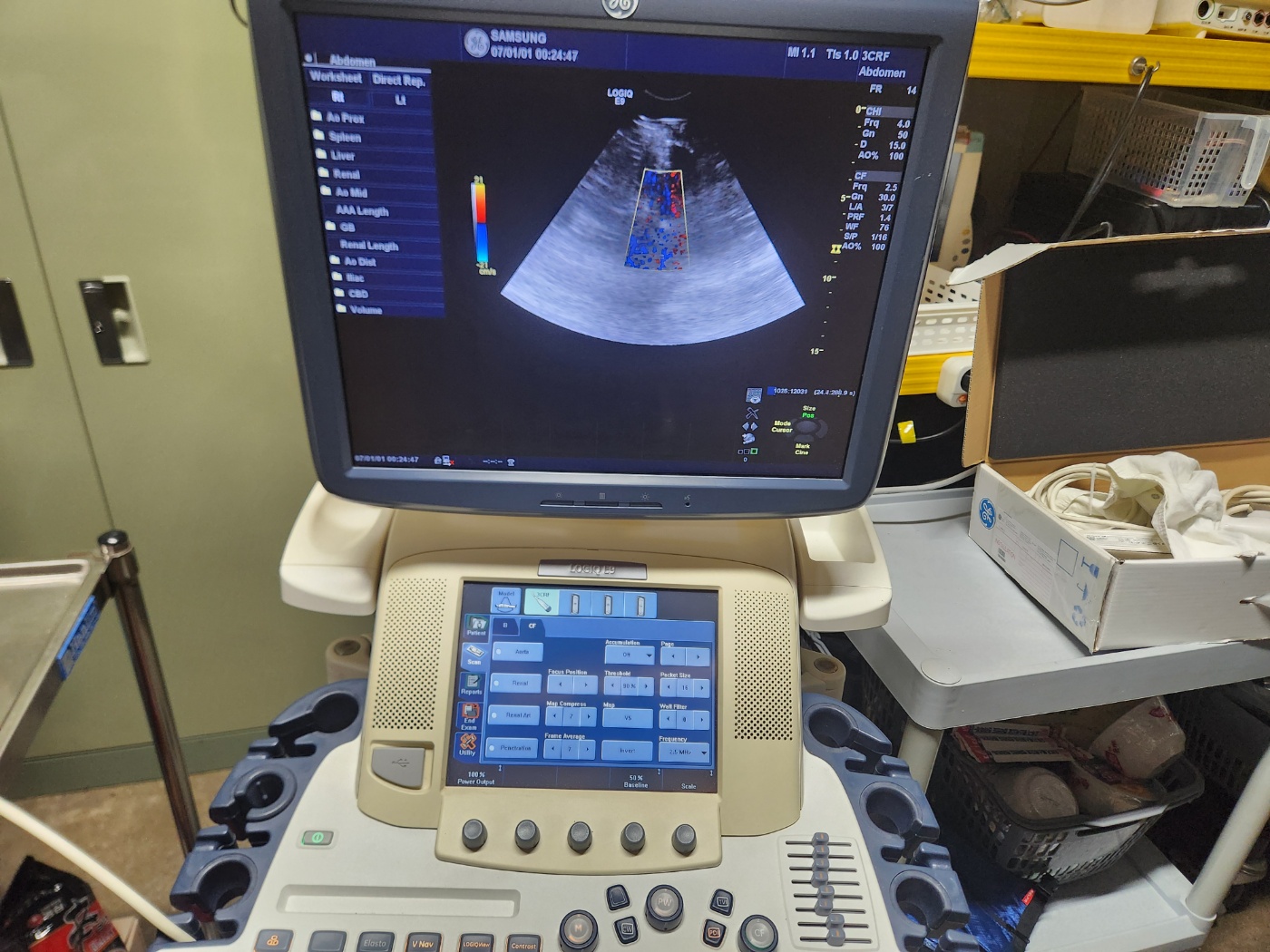 GE 3CRF Curved Array transducer