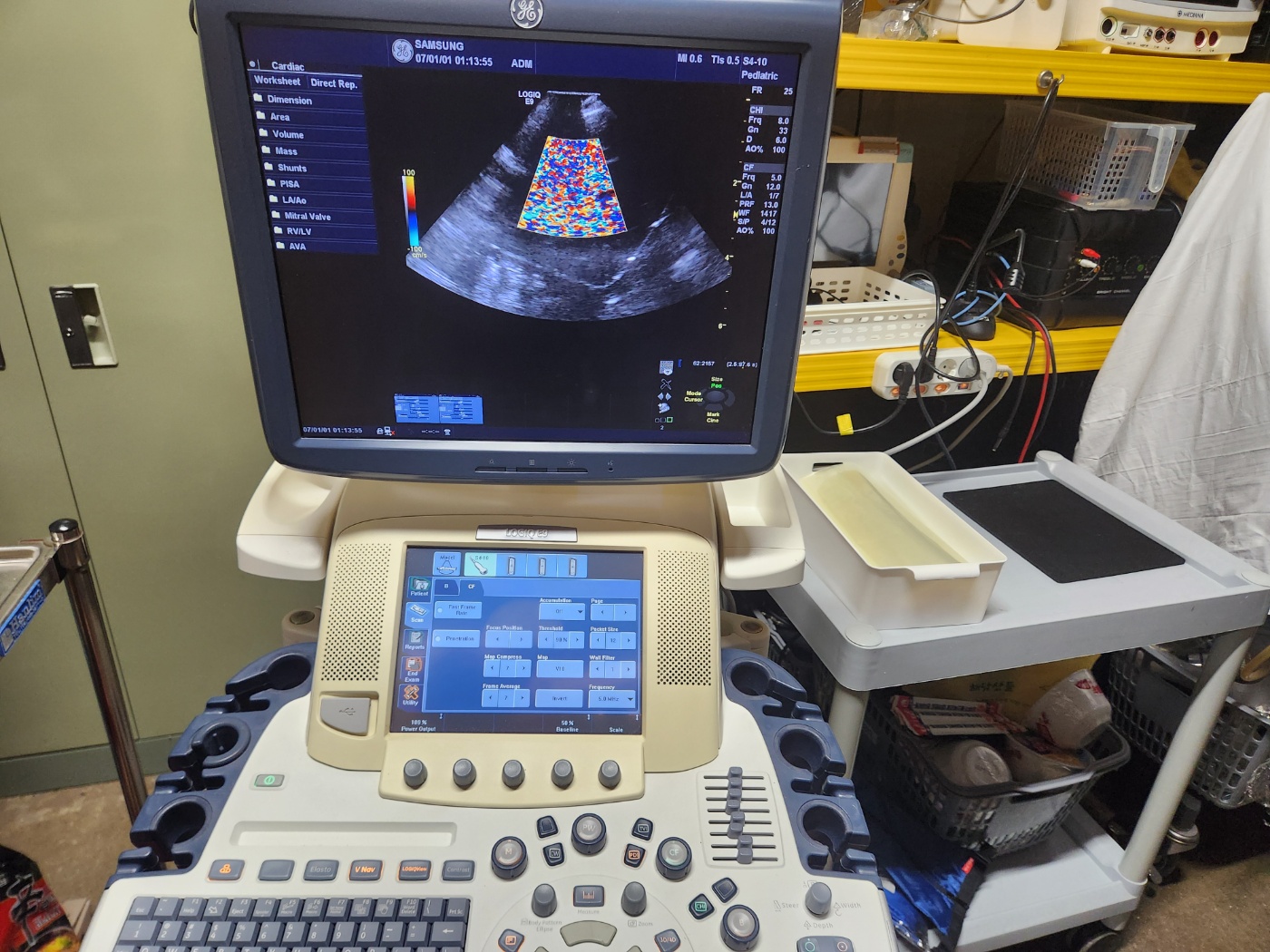 GE S4-10 Probe