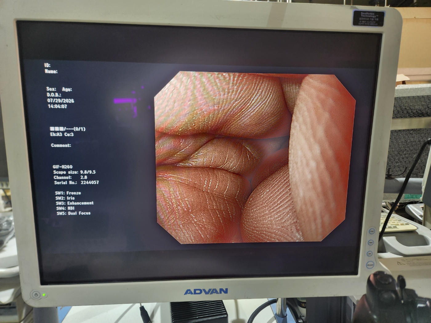 Olympus CV-290 Endoscopy System