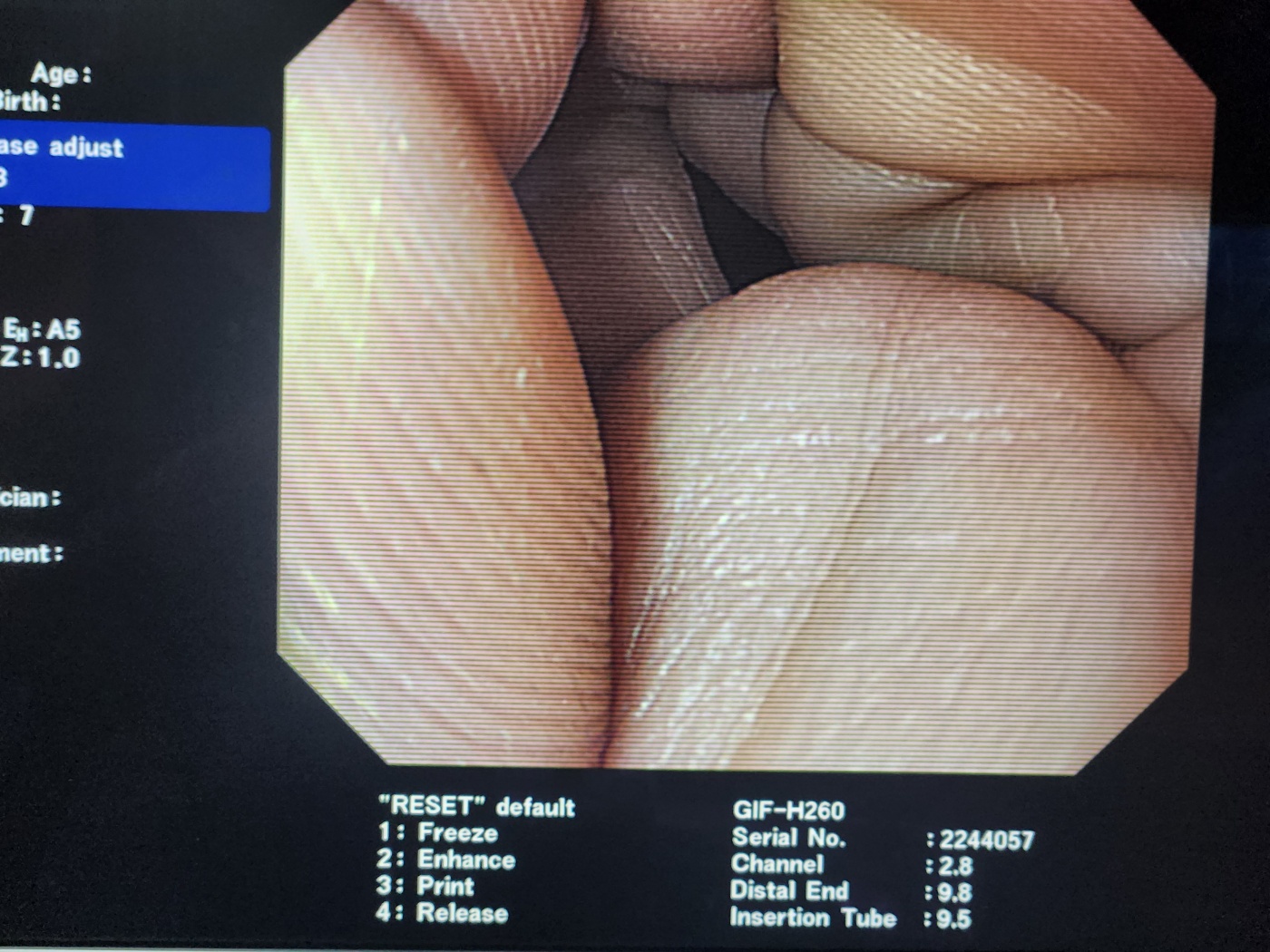 Olympus GIF-H260 Gastroscope