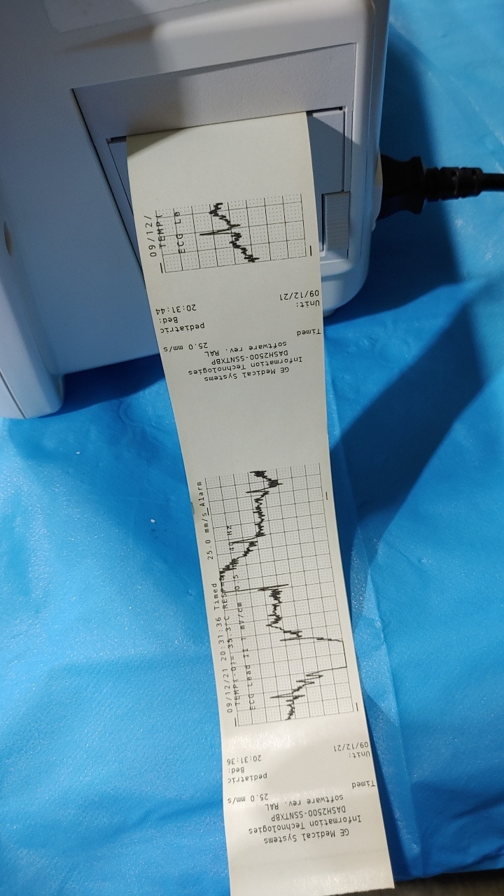 GE Dash 2500 Patient Monitor